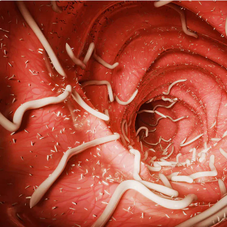 COMPLETE PARASITE ELIMINATION